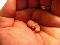 Альбукерке станет первым городом США, где запретят аборты на поздних сроках 