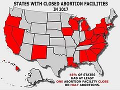 49 abortion facilities closed or halted abortions in 2017