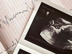 Texas becomes first state to implement ban on aborting babies with detectable heartbeats