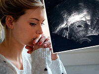 On Pressuring Women to Have Abortions