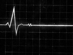 Остановилось сердце