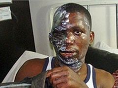 Muslim Extremists in Uganda Throw Acid on Bishop, former Muslim